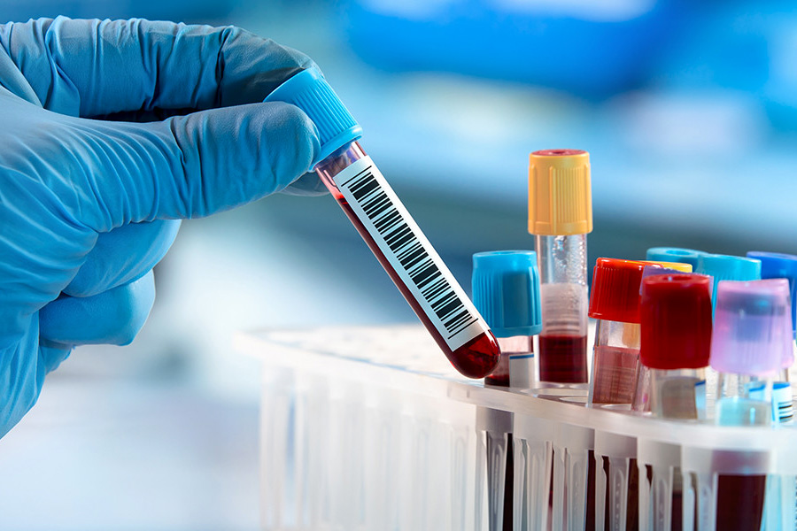 Kanker meetbaar maken: KWF investeert ruim 7 miljoen in bruikbare biomarkers
